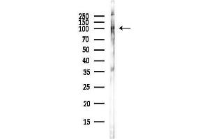 anti-Erythrocyte Membrane Protein Band 4.1 (Elliptocytosis 1, RH-Linked) (EPB41) (pTyr418), (pTyr660) antibody