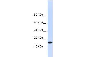WB Suggested Anti-PHLDA3 Antibody Titration: 0. (PHLDA3 抗体  (N-Term))