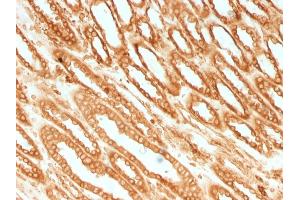 Formalin-fixed, paraffin-embedded human Renal Cell Carcinoma stained with Calnexin Mouse Monoclonal Antibody (CANX/1541). (Calnexin 抗体  (N-Term))