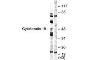 Western Blotting (WB) image for anti-Keratin 18 (KRT18) (AA 21-70) antibody (ABIN2888816) (Cytokeratin 18 抗体  (AA 21-70))