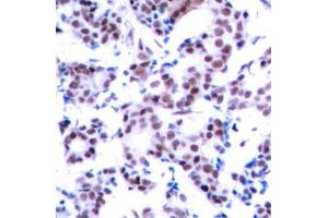 Immunohistochemistry (IHC) image for anti-Jun B Proto-Oncogene (JUNB) (pSer259) antibody (ABIN3020277) (JunB 抗体  (pSer259))
