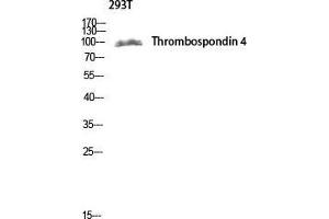 Western Blot (WB) analysis of 293T lysis using Thrombospondin 4 antibody. (THBS4 抗体  (Internal Region))