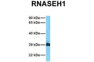 Host:  Rabbit  Target Name:  RNASEH1  Sample Tissue:  Human Jurkat  Antibody Dilution:  1. (Ribonuclease H1 抗体  (Middle Region))