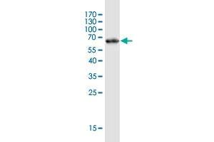 Western Blotting (WB) image for anti-Inhibitor of KB Kinase beta Interacting Protein (IKbIP) (AA 1-377) antibody (ABIN2752278)