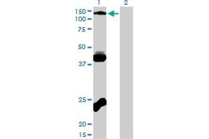 Western Blot analysis of EPHB3 expression in transfected 293T cell line by EPHB3 monoclonal antibody (M01), clone 1B3. (EPH Receptor B3 抗体  (AA 899-997))