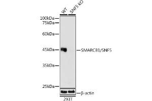 Western blot analysis of extracts from wild type (WT) and SM/SNF5 knockout (KO) 293T cells, using SM/SNF5 antibody (ABIN7270657) at 1:1000 dilution. (SMARCB1 抗体)