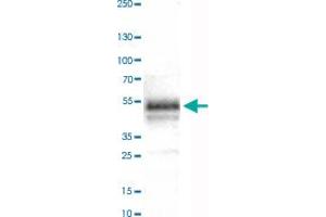 Western Blot analysis of human tonsil tissue lysate with CA12 monoclonal antibody, clone CL0278 . (CA12 抗体)