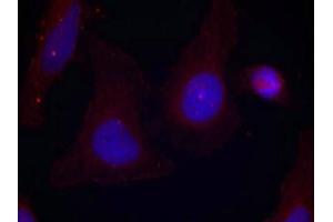 Immunofluorescence staining of methanol-fixed Hela cells using Pyk2(Phospho-Tyr402) Antibody. (PTK2B 抗体  (pTyr402))