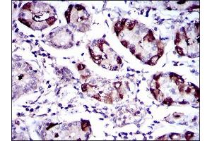 Immunohistochemistry (IHC) image for anti-Solute Carrier Family 27 (Fatty Acid Transporter), Member 5 (SLC27A5) (AA 508-570) antibody (ABIN1724761)