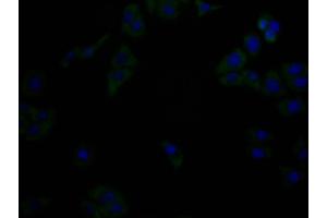 Immunofluorescence staining of Hela cells with(ABIN7176749)at 1:90, counter-stained with DAPI.