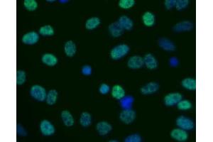 Immunofluorescent staining of human cell line (H2AFX 抗体  (pSer139))