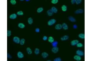Immunofluorescent staining of human cell line