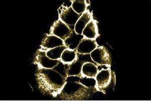 Immunofluorescent staining of A431 cell line with beta-Catenin antibody. (beta Catenin 抗体  (AA 571-781))