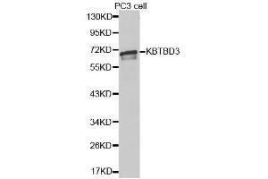 Western blot analysis of extracts of PC-3 cells, using KBTBD3 antibody. (KBTBD3 抗体  (AA 410-607))