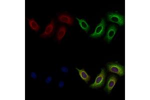 ABIN7094749 and ABIN7098800 staining Hela cells by IF/ICC. (BASP1 抗体  (N-Term))