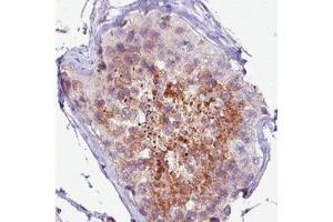 Immunohistochemical staining (Formalin-fixed paraffin-embedded sections) of human testis with PCM1 monoclonal antibody, clone CL0206  shows moderate immunoreactivity in seminiferous tubules. (PCM1 抗体)