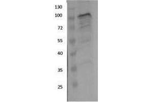 Western Blotting (WB) image for anti-Ewing Sarcoma Breakpoint Region 1 (EWSR1) (Middle Region) antibody (ABIN2779045)