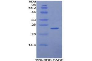 SDS-PAGE analysis of Human Intercellular Adhesion Molecule 4 Protein. (ICAM4 蛋白)