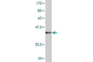 Western Blot detection against Immunogen (46. (Dual Specificity Phosphatase 3 (DUSP3) (AA 1-185) 抗体)