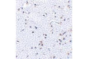 Immunohistochemistry of TSLP in human brain tissue with this product at 2. (Thymic Stromal Lymphopoietin 抗体  (C-Term))