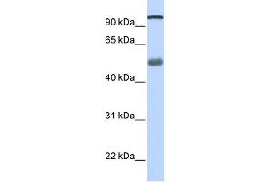 WB Suggested Anti-DHX32 Antibody Titration:  0. (DHX32 抗体  (N-Term))