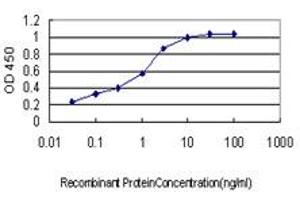 Detection limit for recombinant GST tagged ACACA is approximately 0. (Acetyl-CoA Carboxylase alpha 抗体  (AA 1-99))