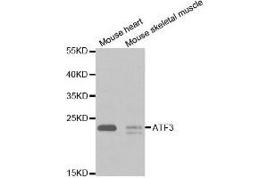 Western Blotting (WB) image for anti-Activating Transcription Factor 3 (ATF3) antibody (ABIN1871129) (ATF3 抗体)