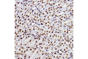 Immunohistochemistry of paraffin-embedded mouse kidney using GTF2F2 Rabbit mAb (ABIN7267373) at dilution of 1:100 (40x lens). (GTF2F2 抗体)