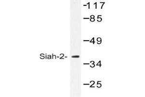 Western blot (WB) analysis of Siah-2 antibody in extracts from COLO cells. (SIAH2 抗体)