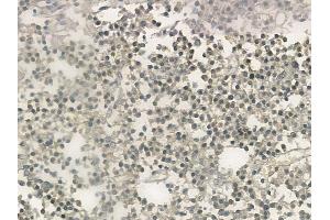ABIN6257578 and ABIN6273604 at 1/100 staining human pituitary adenoma by IHC-P. (ZNF71 抗体)