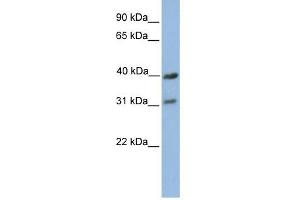 COX3 antibody used at 1 ug/ml to detect target protein. (COX3 抗体  (C-Term))