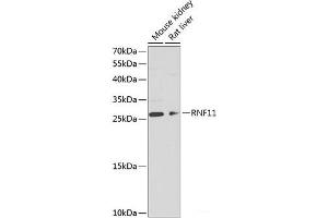 Western blot analysis of extracts of various cell lines using RNF11 Polyclonal Antibody at dilution of 1:1000. (RNF11 抗体)