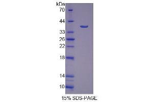 SDS-PAGE analysis of Human SSRa Protein. (SSR1 蛋白)