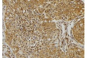 ABIN6273221 at 1/100 staining Human pancreas tissue by IHC-P. (CXCL14 抗体  (Internal Region))