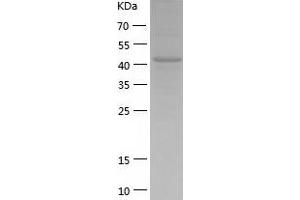 SIL1 Protein (AA 32-461) (His tag)