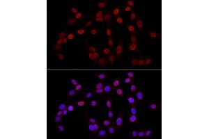 Immunofluorescence (IF) image for anti-Histone 3 (H3) (H3K27me) antibody (ABIN6219521)