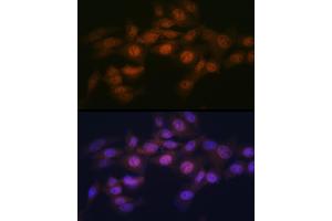 Immunofluorescence analysis of NIH-3T3 cells using WAPL Rabbit mAb (ABIN7271380) at dilution of 1:100 (40x lens). (WAPAL 抗体)