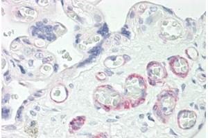 Anti-ZNF322A antibody IHC staining of human placenta. (ZNF322A 抗体  (C-Term))
