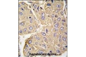 Immunohistochemistry (Paraffin-embedded Sections) (IHC (p)) image for anti-Protein tyrosine Phosphatase, Non-Receptor Type 7 (PTPN7) (AA 22-51) antibody (ABIN391869)