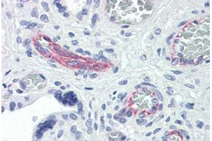 Human Placenta: Formalin-Fixed, Paraffin-Embedded (FFPE) (RND3 抗体  (AA 1-245))