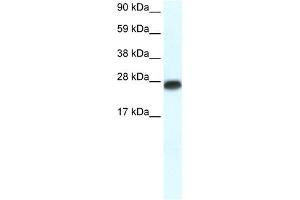 WB Suggested Anti-MYF6 Antibody Titration:  0.