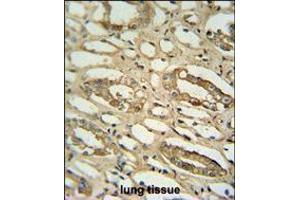 GGTLC2 antibody immunohistochemistry analysis in formalin fixed and paraffin embedded human lung tissue followed by peroxidase conjugation of the secondary antibody and DAB staining.