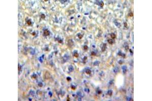 Used in DAB staining on fromalin fixed paraffin-embedded Liver tissue (EGR4 抗体  (AA 231-474))