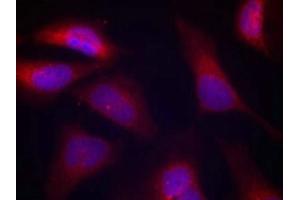 Immunofluorescence staining of methanol-fixed Hela cells using PKR(Phospho-Thr446) Antibody.