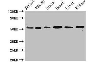 Western Blot Positive WB detected in: Jurkat whole cell lysate, HEK293 whole cell lysate, Mouse brain tissue, Mouse heart tissue, Mouse liver tissue, Mouse kidney tissue All lanes: SLC18A2 antibody at 3. (SLC18A2 抗体  (AA 463-514))