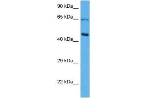 Host:  Mouse  Target Name:  SOX18  Sample Tissue:  Mouse Brain  Antibody Dilution:  1ug/ml (SOX18 抗体  (Middle Region))