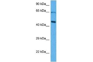Host:  Mouse  Target Name:  SOX18  Sample Tissue:  Mouse Brain  Antibody Dilution:  1ug/ml