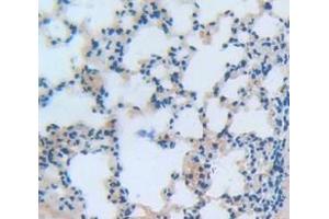 IHC-P analysis of Mouse Tissue, with DAB staining. (NCF2 抗体  (AA 354-525))
