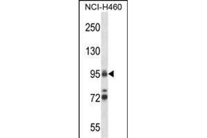 TOP1 Antibody (N-term) (ABIN657818 and ABIN2846785) western blot analysis in NCI- cell line lysates (35 μg/lane).