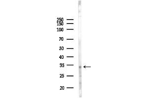 anti-Dehydrogenase/reductase (SDR Family) Member 1 (DHRS1) (Internal Region) antibody